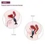 SVAKOM Julie Anal Plug Prostate Massager Adult Sex Toys For Men Remote Control Waterproof Rechargeable Sensuality Anal Vibrators Clitoral Stimulator Toy And Vies For Women Sex Discreet Package(Black)