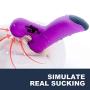 Clitoral Sucking Vibrator, Sexrabbit Rechargeable Heating Dildo Vibrator G Spot Massager Waterproof, Clit Stimulator with 10 Vibration & 3 Suction Patterns Adult Sex Toys for Women Couples