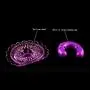YTYC 2 Pcs Womens Breast Nipple Massager Sexual Dual Shock Vibration Chest Massage Vibratorsï¼ˆpurpleï¼‰