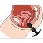 YiFeng Anal Plug Butt Plug Anal Toys - Anal Pleasure - Silicone Anal Trainer, Anal Stimulation and Self Pleasure Masturbation for Men,for Women (Type C)