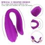 Vibrator for Couple,Rechargeable G spot & Clitoral Stimulator Vibrator with 10 Speed Dual Vibrations.Wireness Remote Control Sex Toy for Women Fun