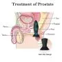 Anal Plug Male Prostate Massager Vibrating Butt Plug 3Pcs Training Kit 9 Vibration Modes with Remote Control Anal Vibrator Sex Toys with Suction Cup Base for Male, Female and Beginner Anal Plug Male Prostate Massager Vibrating Butt Plug 3Pcs Training Kit 9 Vibration Modes with Remote Control Anal Vibrator Sex Toys with Suction Cup Base for Male, Female and Beginner